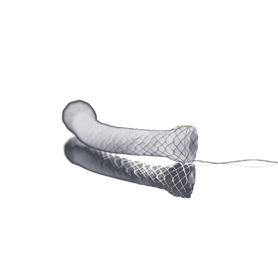 Kaplı Stent — görsel 1