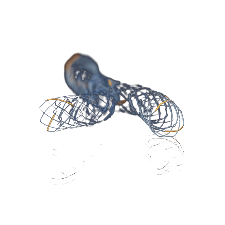 Kapsız Stent