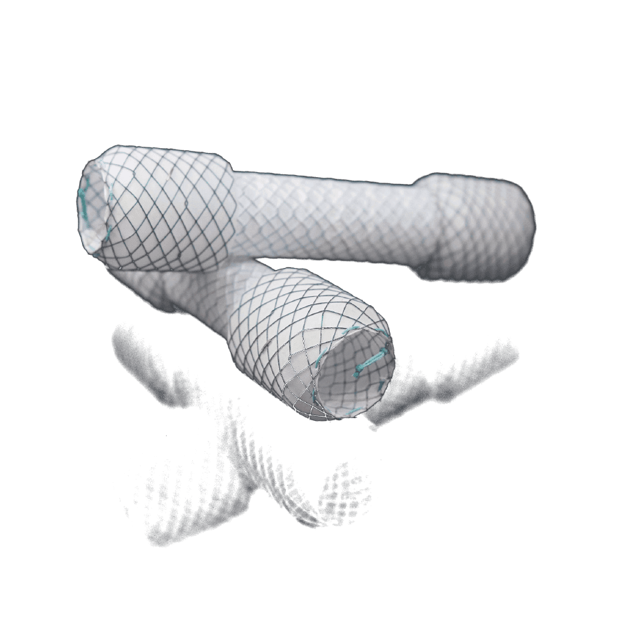 Stent — görsel 1
