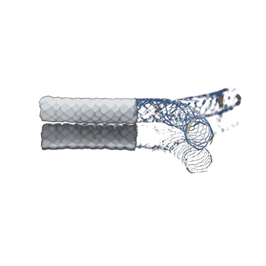 Yarı Kapsız – Yarı Kaplı Stent